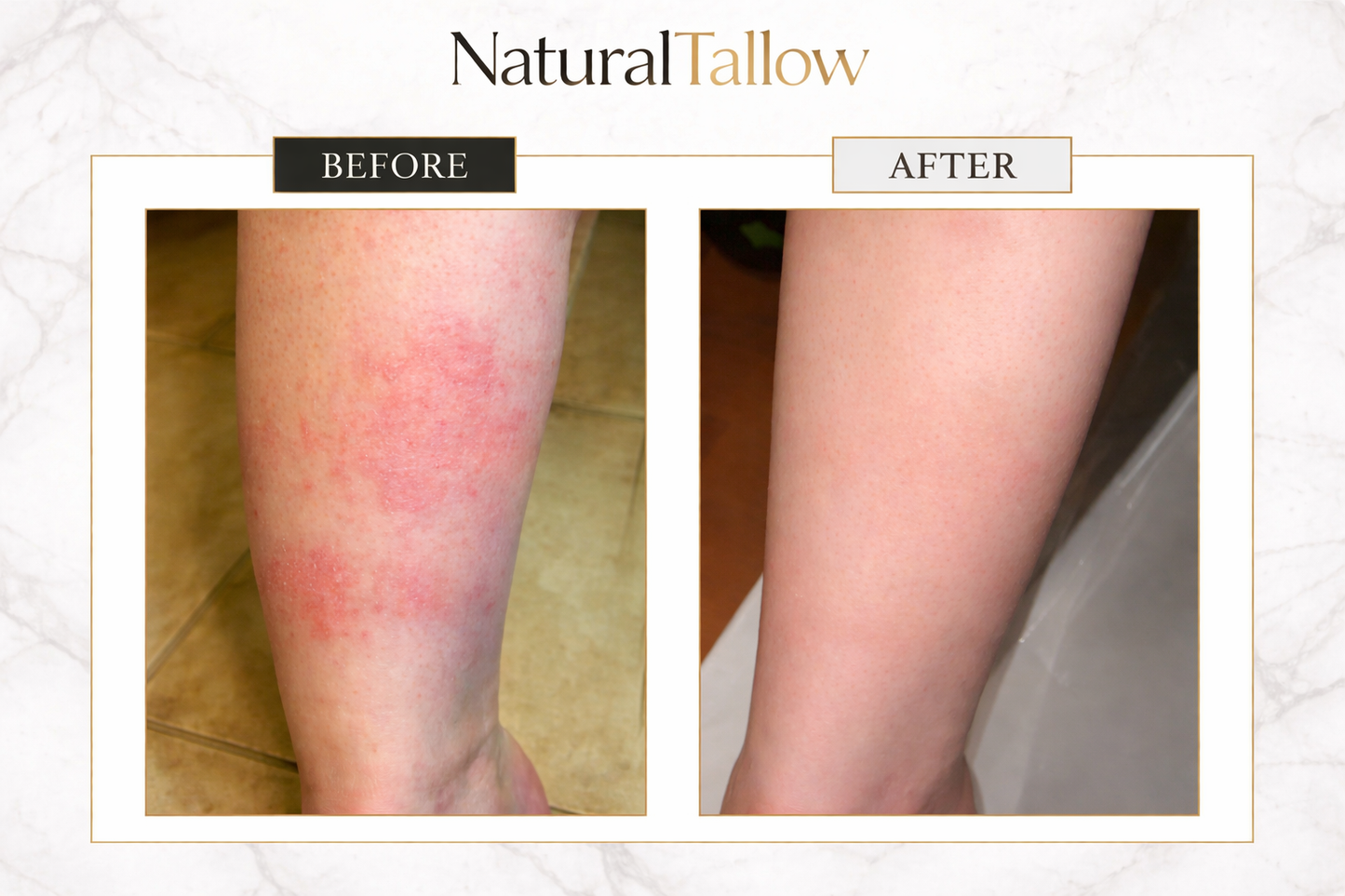 Natural Tallow™ Grass Fed Beef Tallow for Skin & Face - Tallow and Honey Balm - High Quality & Unscented (113g)