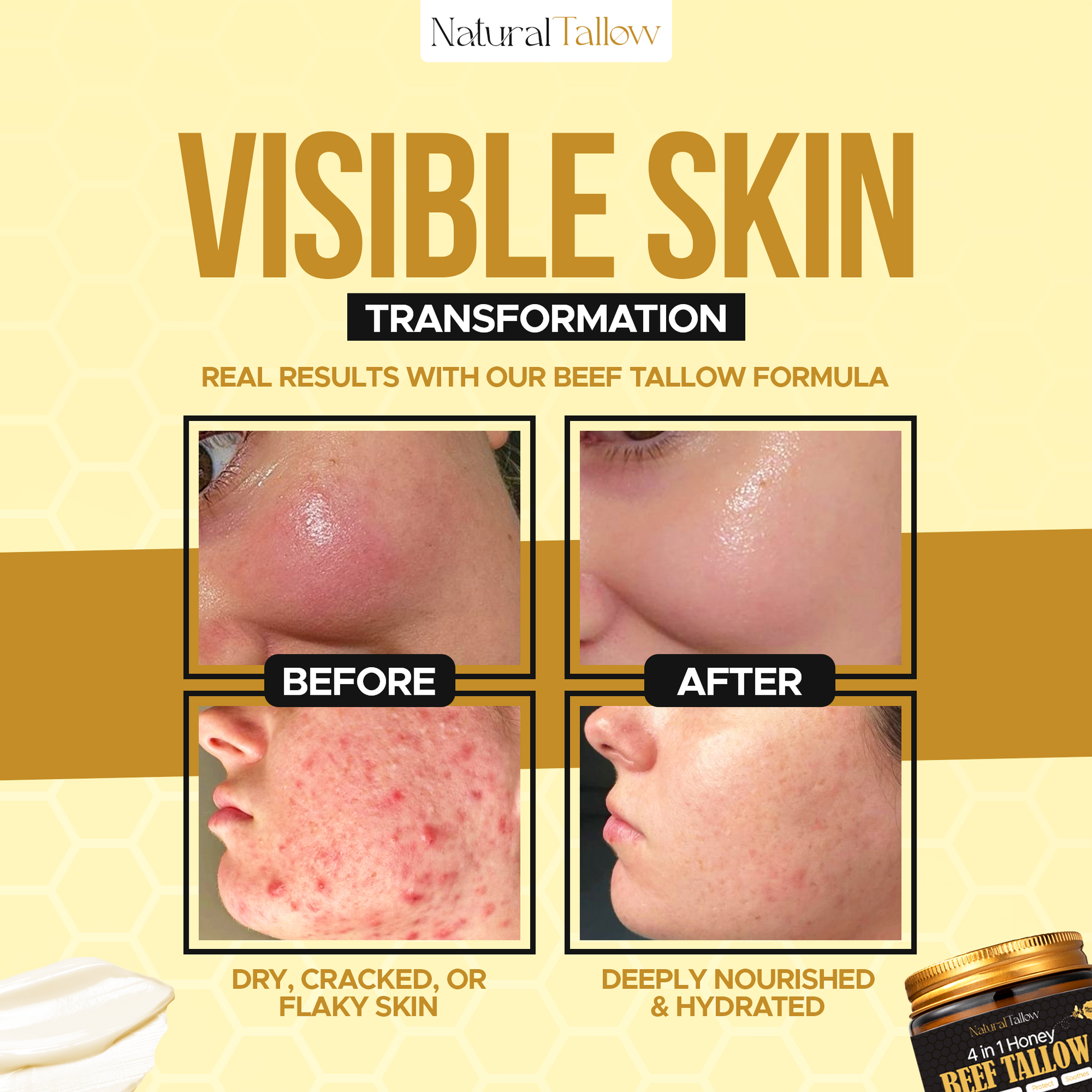 Natural Tallow™ Whipped Beef Tallow Balm with Manuka Honey – High Quality & Unscented (113g)