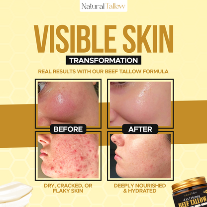 Natural Tallow™ Whipped Beef Tallow Balm with Manuka Honey – High Quality & Unscented (113g)