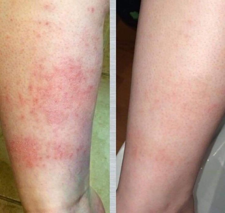 Natural Tallow™ Whipped Beef Tallow Balm with Manuka Honey – High Quality & Unscented (113g)