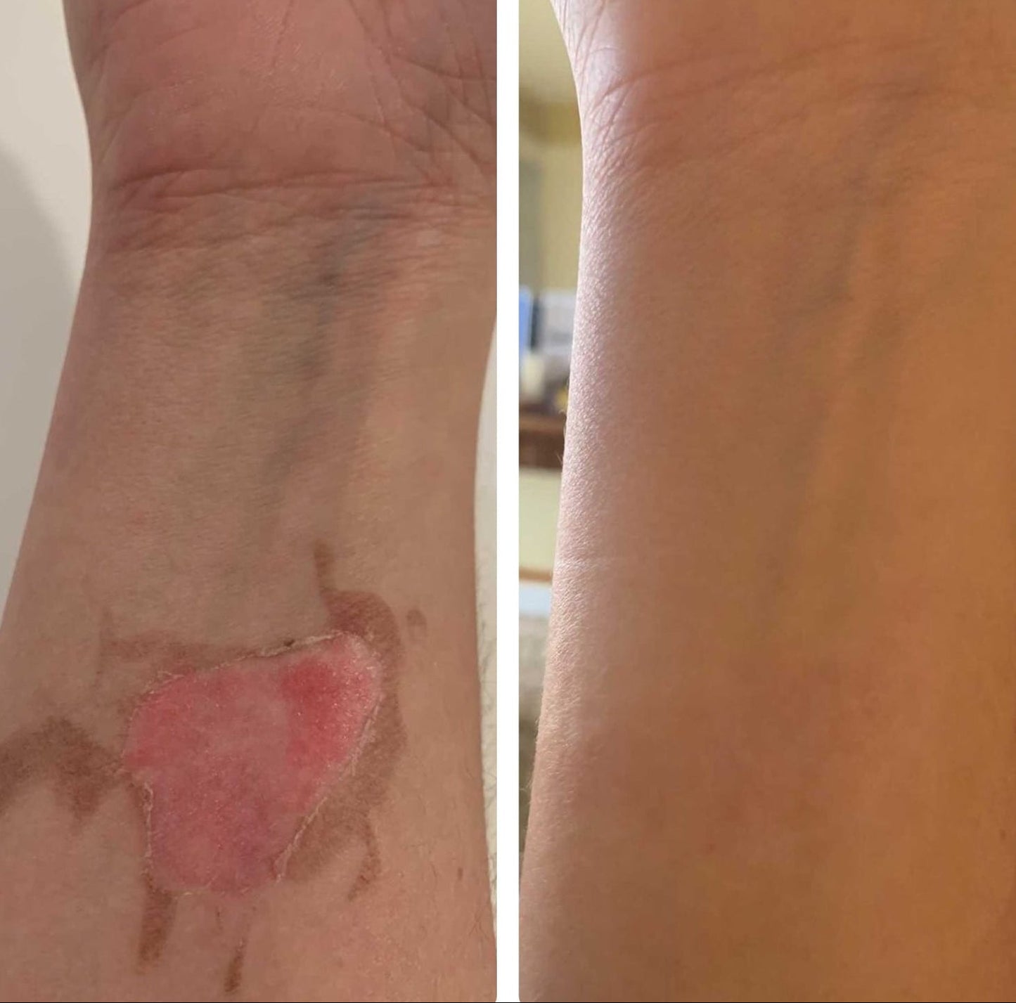 Natural Tallow™ Whipped Beef Tallow Balm with Manuka Honey – High Quality & Unscented (113g)