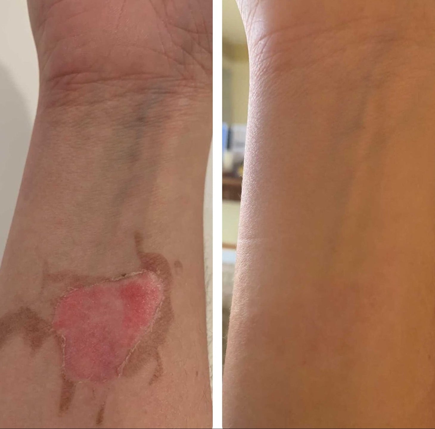 Natural Tallow™ Whipped Beef Tallow Balm with Manuka Honey – High Quality & Unscented (113g)