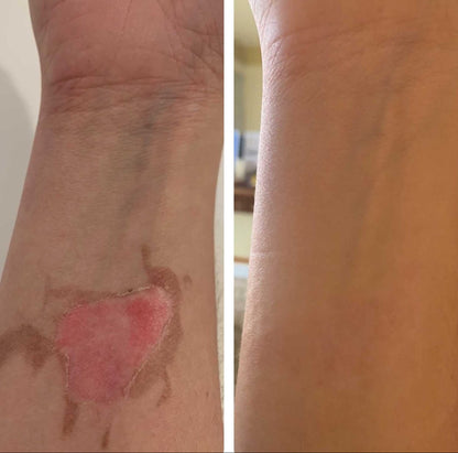 Natural Tallow™ Whipped Beef Tallow Balm with Manuka Honey – High Quality & Unscented (113g)